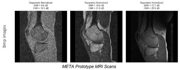 META Prototype MRI Scans